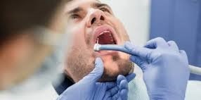 دندانپزشک های سیار عامل اصلی بالارفتن آمار هپاتیت در دنا